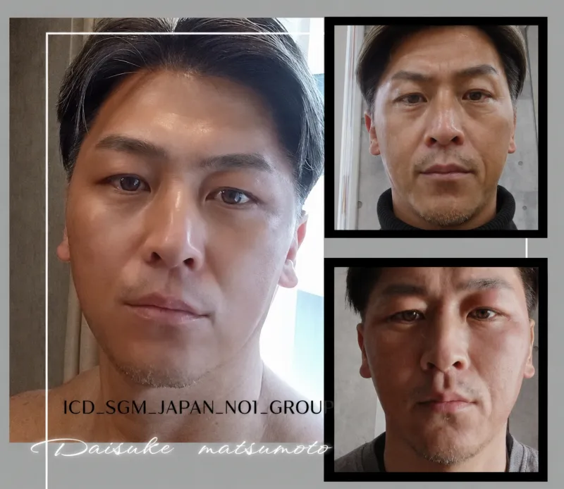 フェイシャル