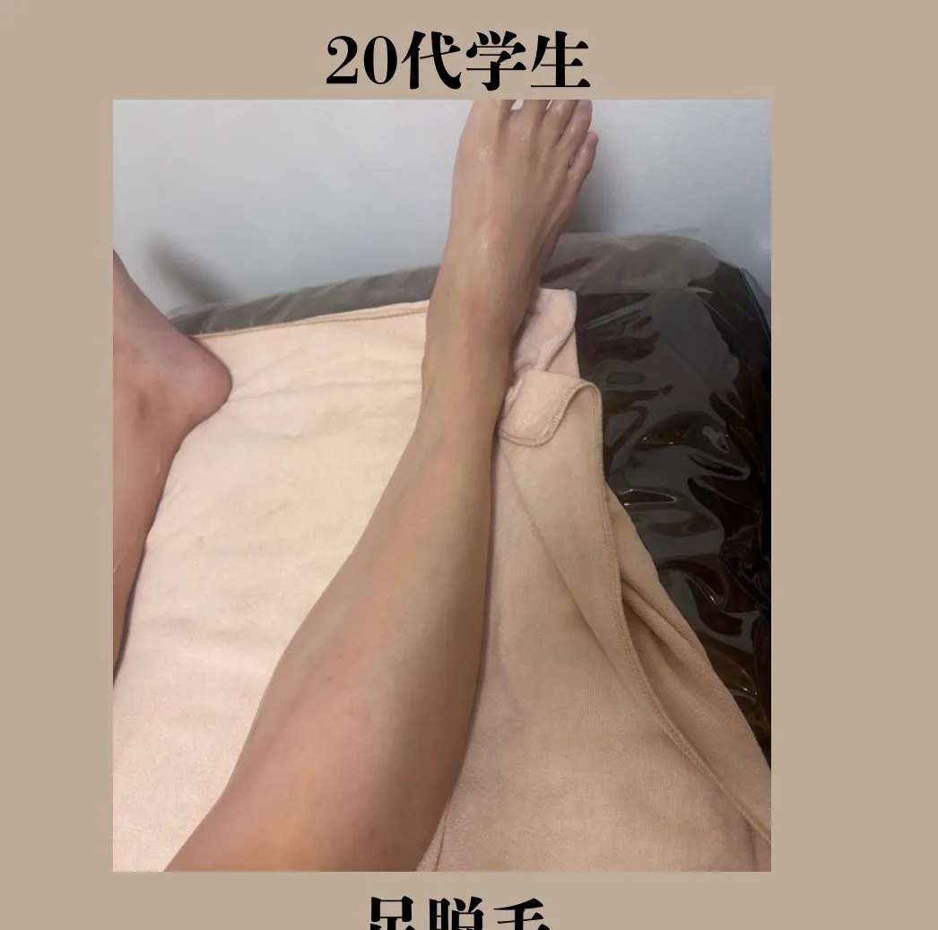 都度払いメンズ脱毛❣️