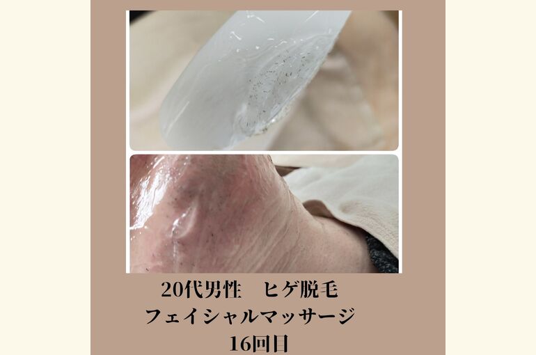 【メンズ】ヒゲ脱毛オススメサロン！都度払いの完全予約制 堺市北野田honey-house