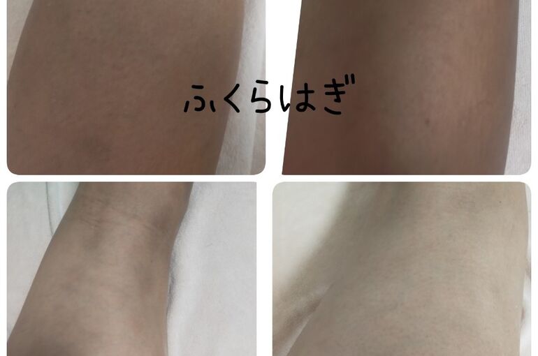 北野田駅すぐ、メンズ可能脱毛サロン！