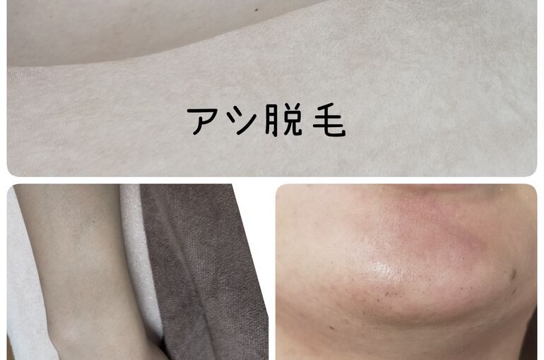 【北野田駅すぐ脱毛サロン】メンズ脱毛可能なサロン　honey-house
