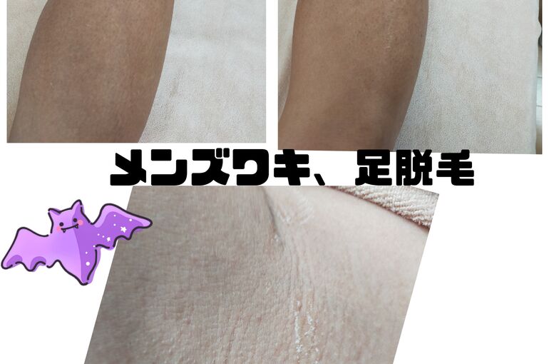 メンズ脱毛がアツい！ヒゲ。脇、腕、足脱毛！堺市北野田駅すぐ