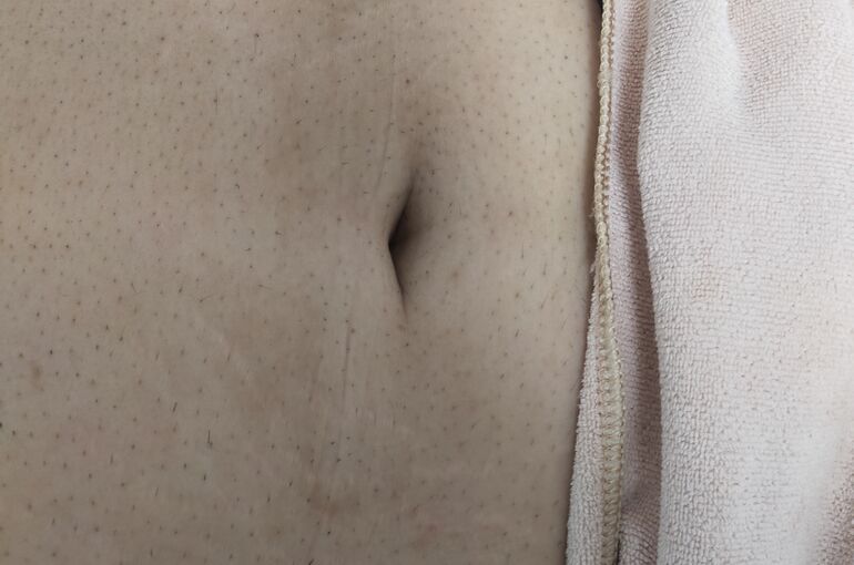 男性、胸。お腹。ヘソ下脱毛！完全個室の脱毛サロン　honey-house