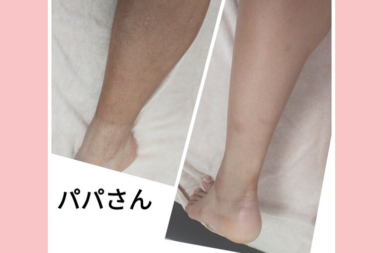 親子で脱毛できるプライベートサロン堺市北野田駅スグ