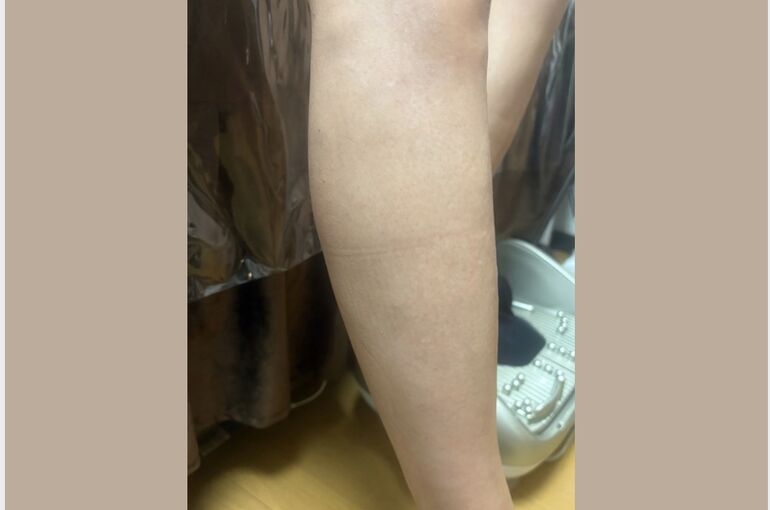 ほんまに綺麗な足、メンズ脱毛がオススメ！