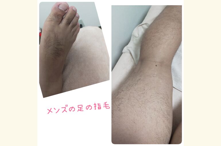 メンズ脱毛。足脱毛、ひざ下脱毛、指の毛脱毛も！堺市北野田駅スグ脱毛サロン
