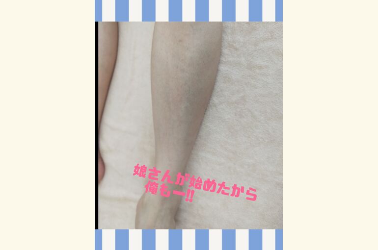 脱毛体験してみませんか？メンズ脱毛、キッズ脱毛、レディース脱毛！堺市東区北野田駅スグ！