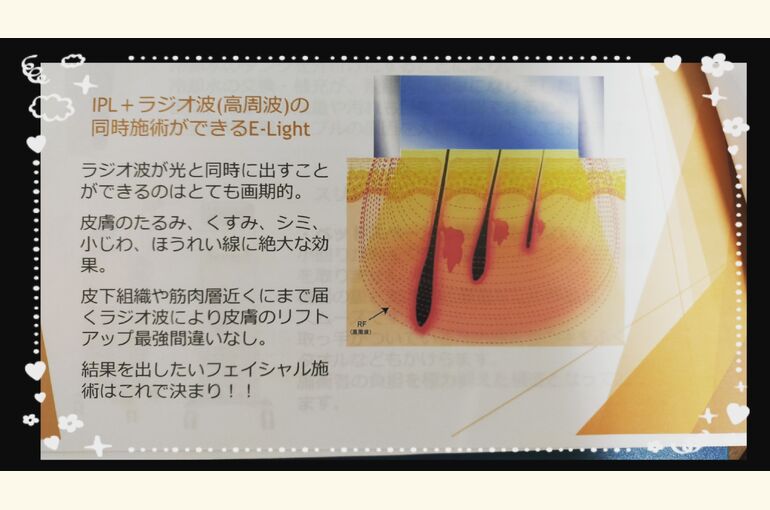 メンズもスキンケアが大事！ラジオ波＋IPLで美肌フォトフェイシャル堺市北野田脱毛サロンhoney-house
