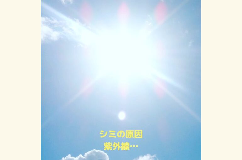 シミの原因は、紫外線!! 脱毛サロンだけど、フォトフェイシャル！堺市北野田honey-house