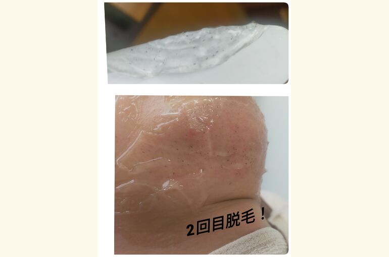 【堺市北野田駅徒歩3分】メンズヒゲ脱毛がおすすめ！完全個室 honey-house