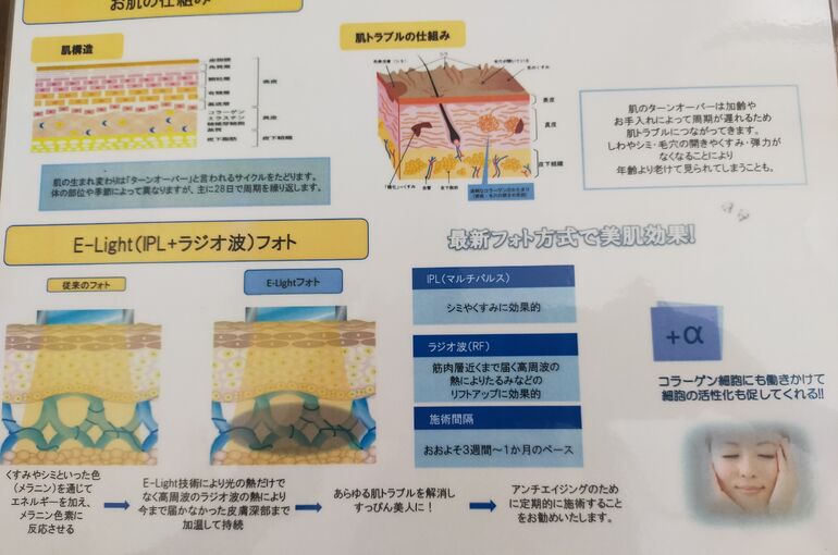 美肌フォトフェイシャルセラピーでシミケア【堺市北野田完全個室！】