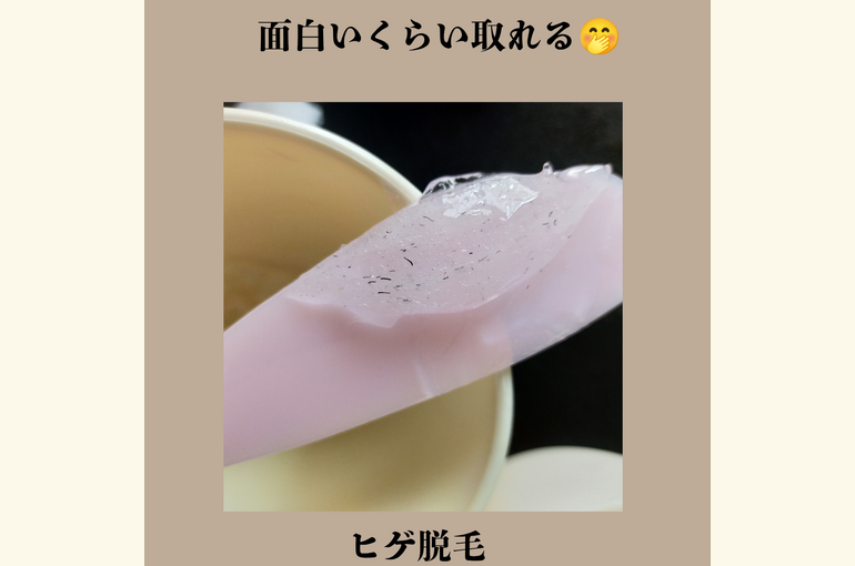 髭剃りもうやめませんか？ヒゲ脱毛がおすすめ堺市北野田でメンズ全身脱毛
