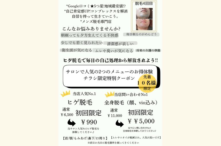 完全予約制で、メンズ全身脱毛が￥11000やるしか無い！