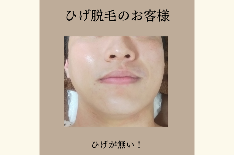 ただの脱毛屋さんじゃない！メンズ脱毛サロン！美肌へ！