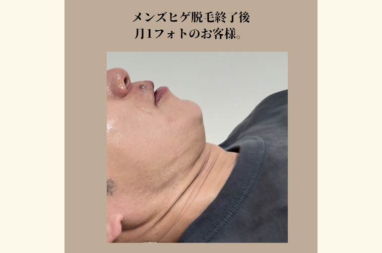 メンズだってここまで綺麗になれるんです！当サロンにお任せ下さい!