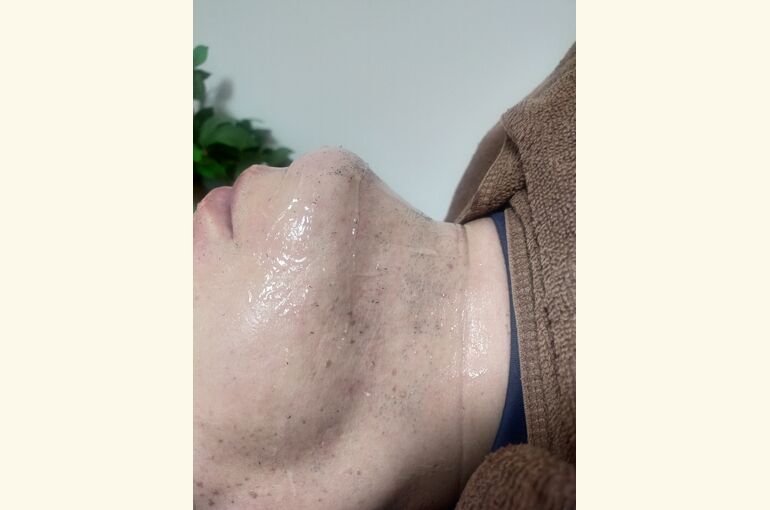 メンズヒゲ脱毛がオススメ!!完全個室の脱毛サロンhoney-house