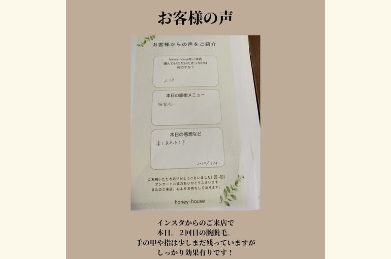 メンズ脱毛、腕脱毛もおすすめ！今ならまだ間にあう！、