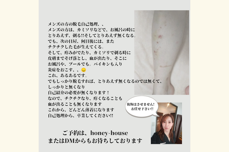 チクチクしない体！自己処理からの卒業！メンズ専門脱毛サロン！